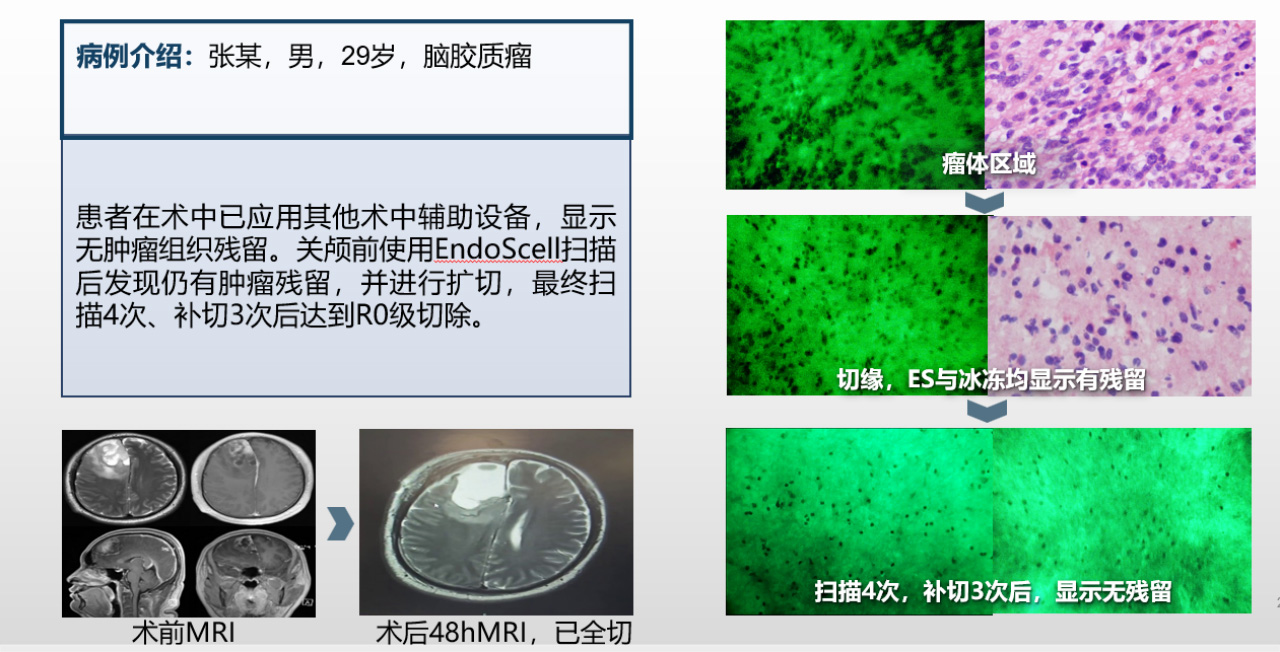 神經(jīng)外科(圖1)
