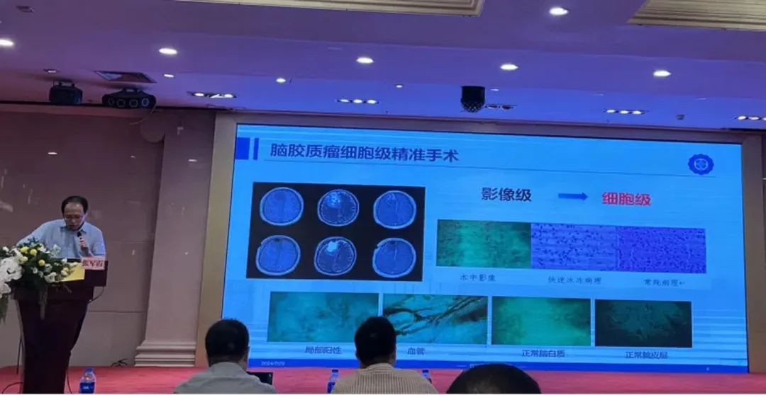 術中手持顯微鏡EndoSCell?助推腦膠質(zhì)瘤診療進入細胞級精準手術時代(圖5)