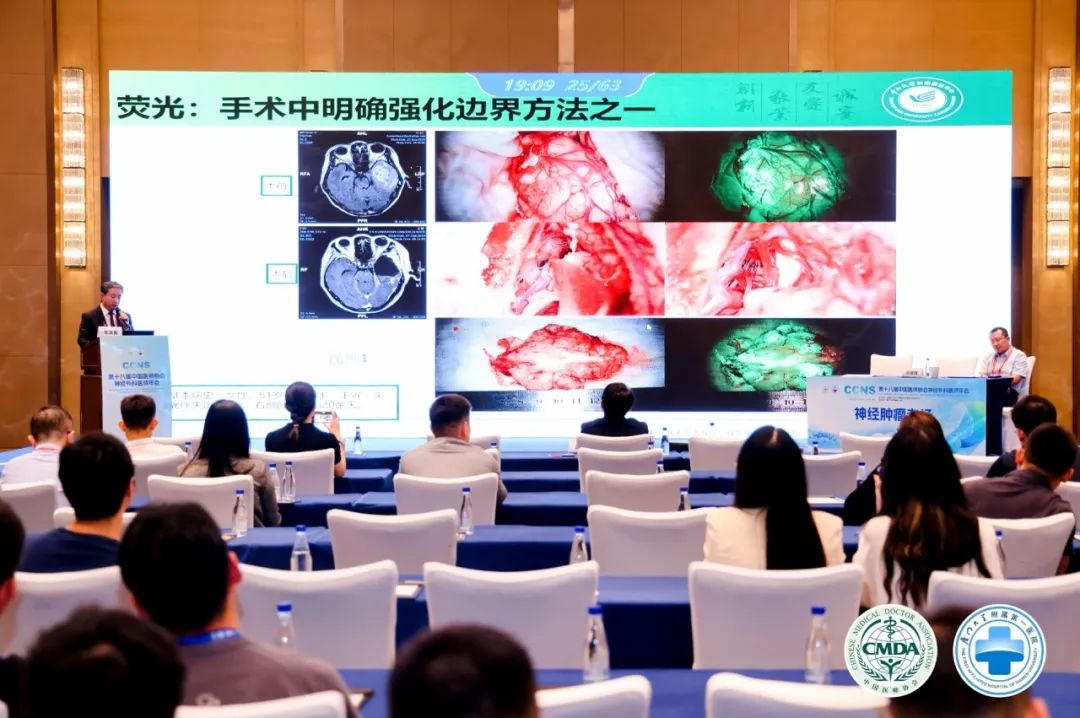 腦膠質(zhì)瘤治療新曙光：EndoSCell?細(xì)胞級精準(zhǔn)手術(shù)方案亮相2024CCNS(圖4)