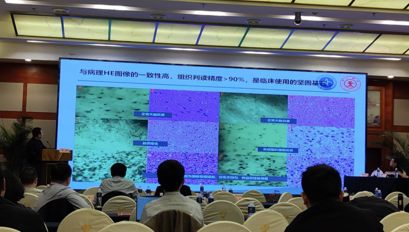 昆明神經(jīng)腫瘤論壇：EndoSCell?細(xì)胞級(jí)熒光導(dǎo)引技術(shù)開啟精準(zhǔn)手術(shù)新時(shí)代(圖4)